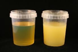 punto de congelaci&oacute;n